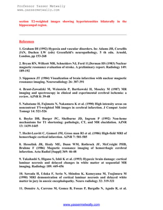 Professor Yasser Metwally
www.yassermetwally.com

section T2-weighted images showing hyperintensities bilaterally in the
hippocampal region.

References
1. Graham DI (1992) Hypoxia and vascular disorders. In: Adams JH, Corsellis
JAN, Duchen LW (eds) Greenfield's neuropathology. 5 th edn. Arnold,
London, pp 153-268
2. Bryan RN, Willcott MR, Schneiders NJ, Ford 11,Derman HS (1983) Nuclear
magnetic resonance evaluation of stroke. A preliminary report. Radiology 149:
189-192
3. Sipponen JT (1984) Visualization of brain infarction with nuclear magnetic
resonance imaging. Neuroradiology 26: 387-391
4. Brant-Zawadzki M, Weinstein P, Bartkowski H, Moseley M (1987) MR
imaging and spectroscopy in clinical and experimental cerebral ischemia: a
review. AJNR 8: 39-48
5. Nabatame H, Fujimoto N, Nakamura K et al. (1990) High intensity areas on
noncontrast T'l-weighted MR images in cerebral infarction. J Comput Assist
Tomogr 14: 521-526
6. Boyko DB, Burger PC, Shelburne JD, Ingram P (1992) Non-heme
mechanisms for T1 shortening: pathologic, CT, and MR elucidation. AJNR
13: 1439-1445
7. Hecht-Leavitt C, Gomori JM, Gross man RI et al. (1986) High-field MRI of
hemorrhagic cortical infarction. AJNR 7: 581-585
8. Hesselink JR, Healy ME, Dunn WM, Rothrock JF, McCreight PHB,
Brahme F (1986) Magnetic resonance imaging of hemorrhagic cerebral
infarction. Acta Radiol [Suppl] 369: 46-48
9. Takahashi S, Higano S, Ishii K et al. (1993) Hypoxic brain damage: cortical
laminar necrosis and delayed changes in white matter at sequential MR
imaging. Radiology 189: 449-456
10. Sawada H, Udaka F, Seriu N, Shindou K, Kameyama M, Tsujimura M
(1990) MRI demonstration of cortical laminar necrosis and delayed white
matter in jury in anoxic encephalopathy. Neuro radiology 32: 319-321
11. Donaire A, Carreno M, Gomez B, Fossas P, Bargallo N, Agudo R, et al.

www.yassermetwally.com

 