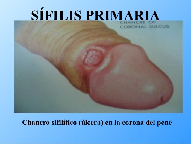Como aumentar el miembro viril las bolitas