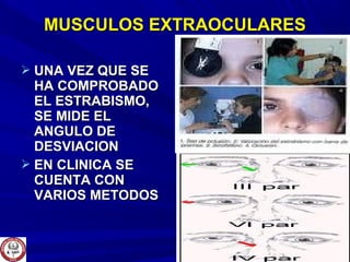  UNA VEZ QUE SEUNA VEZ QUE SE
HA COMPROBADOHA COMPROBADO
EL ESTRABISMO,EL ESTRABISMO,
SE MIDE ELSE MIDE EL
ANGULO DEANGULO DE
DESVIACIONDESVIACION
 EN CLINICA SEEN CLINICA SE
CUENTA CONCUENTA CON
VARIOS METODOSVARIOS METODOS
MUSCULOS EXTRAOCULARESMUSCULOS EXTRAOCULARES
 