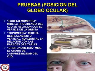 PRUEBAS (POSICION DELPRUEBAS (POSICION DEL
GLOBO OCULAR)GLOBO OCULAR)
 ““EXOFTALMOMETRIA”EXOFTALMOMETRIA”
MIDE LA PROCIDENCIA DELMIDE LA PROCIDENCIA DEL
OJO EN RELACION CON ELOJO EN RELACION CON EL
VERTICE DE LA ORBITAVERTICE DE LA ORBITA
 ““TOPOMETRIA” MIDE ELTOPOMETRIA” MIDE EL
DESPLAZAMIENTODESPLAZAMIENTO
VERTICAL, HORIZONTAL ENVERTICAL, HORIZONTAL EN
RELACION CON LASRELACION CON LAS
PAREDES ORBITARIASPAREDES ORBITARIAS
 ““ORBITONOMETRIA” MIDEORBITONOMETRIA” MIDE
EL GRADO DEEL GRADO DE
COMPRESIBILIDAD DELCOMPRESIBILIDAD DEL
OJOOJO
 