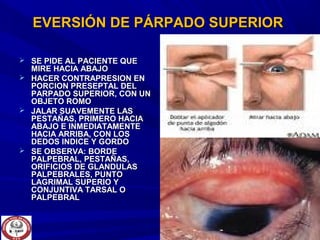 EVERSIÓN DE PÁRPADO SUPERIOREVERSIÓN DE PÁRPADO SUPERIOR
 SE PIDE AL PACIENTE QUESE PIDE AL PACIENTE QUE
MIRE HACIA ABAJOMIRE HACIA ABAJO
 HACER CONTRAPRESION ENHACER CONTRAPRESION EN
PORCION PRESEPTAL DELPORCION PRESEPTAL DEL
PARPADO SUPERIOR, CON UNPARPADO SUPERIOR, CON UN
OBJETO ROMOOBJETO ROMO
 JALAR SUAVEMENTE LASJALAR SUAVEMENTE LAS
PESTAÑAS, PRIMERO HACIAPESTAÑAS, PRIMERO HACIA
ABAJO E INMEDIATAMENTEABAJO E INMEDIATAMENTE
HACIA ARRIBA, CON LOSHACIA ARRIBA, CON LOS
DEDOS INDICE Y GORDODEDOS INDICE Y GORDO
 SE OBSERVA: BORDESE OBSERVA: BORDE
PALPEBRAL, PESTAÑAS,PALPEBRAL, PESTAÑAS,
ORIFICIOS DE GLANDULASORIFICIOS DE GLANDULAS
PALPEBRALES, PUNTOPALPEBRALES, PUNTO
LAGRIMAL SUPERIO YLAGRIMAL SUPERIO Y
CONJUNTIVA TARSAL OCONJUNTIVA TARSAL O
PALPEBRALPALPEBRAL
 