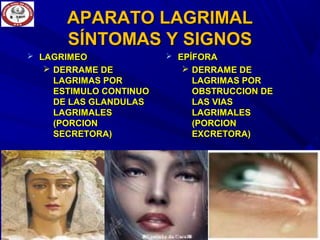 APARATO LAGRIMALAPARATO LAGRIMAL
SÍNTOMAS Y SIGNOSSÍNTOMAS Y SIGNOS
 LAGRIMEOLAGRIMEO
 DERRAME DEDERRAME DE
LAGRIMAS PORLAGRIMAS POR
ESTIMULO CONTINUOESTIMULO CONTINUO
DE LAS GLANDULASDE LAS GLANDULAS
LAGRIMALESLAGRIMALES
(PORCION(PORCION
SECRETORA)SECRETORA)
 EPÍFORAEPÍFORA
 DERRAME DEDERRAME DE
LAGRIMAS PORLAGRIMAS POR
OBSTRUCCION DEOBSTRUCCION DE
LAS VIASLAS VIAS
LAGRIMALESLAGRIMALES
(PORCION(PORCION
EXCRETORA)EXCRETORA)
 