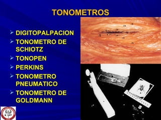 TONOMETROSTONOMETROS
 DIGITOPALPACIONDIGITOPALPACION
 TONOMETRO DETONOMETRO DE
SCHIOTZSCHIOTZ
 TONOPENTONOPEN
 PERKINSPERKINS
 TONOMETROTONOMETRO
PNEUMATICOPNEUMATICO
 TONOMETRO DETONOMETRO DE
GOLDMANNGOLDMANN
 