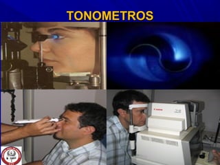 TONOMETROSTONOMETROS
 