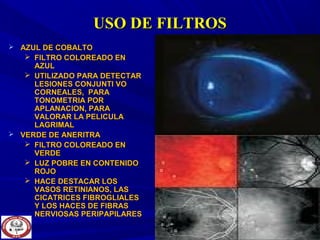 USO DE FILTROSUSO DE FILTROS
 AZUL DE COBALTOAZUL DE COBALTO
 FILTRO COLOREADO ENFILTRO COLOREADO EN
AZULAZUL
 UTILIZADO PARA DETECTARUTILIZADO PARA DETECTAR
LESIONES CONJUNTI VOLESIONES CONJUNTI VO
CORNEALES, PARACORNEALES, PARA
TONOMETRIA PORTONOMETRIA POR
APLANACION, PARAAPLANACION, PARA
VALORAR LA PELICULAVALORAR LA PELICULA
LAGRIMALLAGRIMAL
 VERDE DE ANERITRAVERDE DE ANERITRA
 FILTRO COLOREADO ENFILTRO COLOREADO EN
VERDEVERDE
 LUZ POBRE EN CONTENIDOLUZ POBRE EN CONTENIDO
ROJOROJO
 HACE DESTACAR LOSHACE DESTACAR LOS
VASOS RETINIANOS, LASVASOS RETINIANOS, LAS
CICATRICES FIBROGLIALESCICATRICES FIBROGLIALES
Y LOS HACES DE FIBRASY LOS HACES DE FIBRAS
NERVIOSAS PERIPAPILARESNERVIOSAS PERIPAPILARES
 
