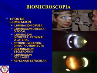 BIOMICROSCOPIABIOMICROSCOPIA
 TIPOS DETIPOS DE
ILUMINACIONILUMINACION
 ILUMINACION DIFUSAILUMINACION DIFUSA
 ILUMINACION DIRECTAILUMINACION DIRECTA
O FOCALO FOCAL
 ILUMINACIONILUMINACION
INDIRECTA, PROXIMALINDIRECTA, PROXIMAL
O LATERALO LATERAL
 RETROILUMINACION,RETROILUMINACION,
DIRECTA O INDIRECTADIRECTA O INDIRECTA
 DISEMINACIONDISEMINACION
ESCLEROTICAESCLEROTICA
 ILUMINACIONILUMINACION
OSCILANTEOSCILANTE
 REFLEXION ESPECULARREFLEXION ESPECULAR
 