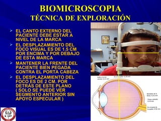BIOMICROSCOPIABIOMICROSCOPIA
TÉCNICA DE EXPLORACIÓNTÉCNICA DE EXPLORACIÓN
 EL CANTO EXTERNO DELEL CANTO EXTERNO DEL
PACIENTE DEBE ESTAR APACIENTE DEBE ESTAR A
NIVEL DE LA MARCANIVEL DE LA MARCA
 EL DESPLAZAMIENTO DELEL DESPLAZAMIENTO DEL
FOCO VISUAL ES DE 1.5 CMFOCO VISUAL ES DE 1.5 CM
POR ENCIMA Y POR DEBAJOPOR ENCIMA Y POR DEBAJO
DE ESTA MARCADE ESTA MARCA
 MANTENER LA FRENTE DELMANTENER LA FRENTE DEL
PACIENTE BIEN PEGADAPACIENTE BIEN PEGADA
CONTRA EL PORTA CABEZACONTRA EL PORTA CABEZA
 EL DESPLAZAMIENTO DELEL DESPLAZAMIENTO DEL
FOCO ES DE 2 CM. PORFOCO ES DE 2 CM. POR
DETRÁS DE ESTE PLANODETRÁS DE ESTE PLANO
( SOLO SE PUEDE VER( SOLO SE PUEDE VER
SEGMENTO ANTERIOR SINSEGMENTO ANTERIOR SIN
APOYO ESPECULAR )APOYO ESPECULAR )
 