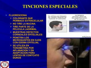TINCIONES ESPECIALESTINCIONES ESPECIALES
 FLUORESCEINAFLUORESCEINA
 COLORANTE QUECOLORANTE QUE
PERMACE EXTRACELULARPERMACE EXTRACELULAR
 NO TIÑE LA MUCINANO TIÑE LA MUCINA
 TIÑE PARTE DE LATIÑE PARTE DE LA
PELICULA LAGRIMALPELICULA LAGRIMAL
 MUESTRAS DEFECTOSMUESTRAS DEFECTOS
CORNEALES EPITELIALESCORNEALES EPITELIALES
 PENETRA LOSPENETRA LOS
MICROQUISTES EN OJOSMICROQUISTES EN OJOS
CON EDEMA EPITELIALCON EDEMA EPITELIAL
 SE UTILIZA ENSE UTILIZA EN
TONOMETRIA PORTONOMETRIA POR
APLANACION Y ENAPLANACION Y EN
ADAPTACION PARAADAPTACION PARA
LENTES DE CONTCATOLENTES DE CONTCATO
DUROSDUROS
 