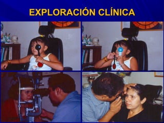 EXPLORACIÓN CLÍNICAEXPLORACIÓN CLÍNICA
 