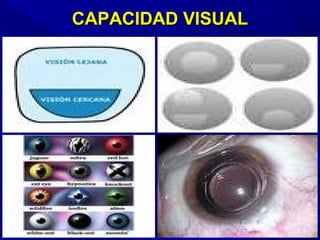 CAPACIDAD VISUALCAPACIDAD VISUAL
 