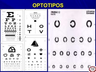 OPTOTIPOSOPTOTIPOS
 