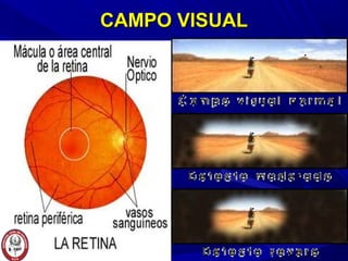 CAMPO VISUALCAMPO VISUAL
 