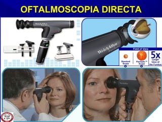 OFTALMOSCOPIA DIRECTAOFTALMOSCOPIA DIRECTA
 
