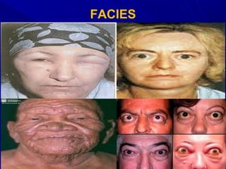 FACIES
 