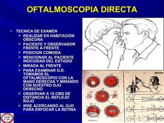 OFTALMOSCOPIA DIRECTAOFTALMOSCOPIA DIRECTA
 TECNICA DE EXAMENTECNICA DE EXAMEN
 REALIZAR EN HABITACIONREALIZAR EN HABITACION
OBSCURAOBSCURA
 PACIENTE Y OBSERVADORPACIENTE Y OBSERVADOR
FRENTE A FRENTEFRENTE A FRENTE
 POSICION COMODAPOSICION COMODA
 MENCIONAR AL PACIENTEMENCIONAR AL PACIENTE
INOCUIDAD DEL ESTUDIOINOCUIDAD DEL ESTUDIO
 MIRADA AL FRENTEMIRADA AL FRENTE
 PARA EXAMINAR O.D.PARA EXAMINAR O.D.
TOMAMOS ELTOMAMOS EL
OFTALMOSCOPIO CON LAOFTALMOSCOPIO CON LA
MANO DERECHA Y MIRANDOMANO DERECHA Y MIRANDO
CON NUESTRO OJOCON NUESTRO OJO
DERECHODERECHO
 OBSERVAR A 15 CMS DEOBSERVAR A 15 CMS DE
DISTANCIA EL REFLEJODISTANCIA EL REFLEJO
ROJOROJO
 IRSE ACERCANDO AL OJOIRSE ACERCANDO AL OJO
PARA ENFOCAR LA RETINAPARA ENFOCAR LA RETINA
 
