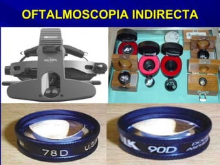 OFTALMOSCOPIA INDIRECTAOFTALMOSCOPIA INDIRECTA
 