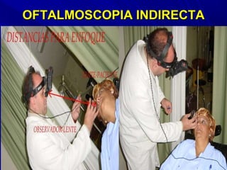 OFTALMOSCOPIA INDIRECTAOFTALMOSCOPIA INDIRECTA
 