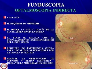 FUNDUSCOPIAFUNDUSCOPIA
OFTALMOSCOPIA INDIRECTAOFTALMOSCOPIA INDIRECTA
VENTAJAS :VENTAJAS :
SE REQUIERE DE MIDRIASISSE REQUIERE DE MIDRIASIS
SE DIRIGE LA LUZ A TRAVÉS DE LASE DIRIGE LA LUZ A TRAVÉS DE LA
LENTE AÉREA HACIA LA PUPILALENTE AÉREA HACIA LA PUPILA
EL FOCO SE REALIZA CON ELEL FOCO SE REALIZA CON EL
DESPLAZAMIENTO ANTEROPOSTERIORDESPLAZAMIENTO ANTEROPOSTERIOR
DEL LENTE AÉREODEL LENTE AÉREO
REQUIERE UNA EXPERIENCIA AMPLIAREQUIERE UNA EXPERIENCIA AMPLIA
PARA LOCALIZAR ALTERACIONES PORPARA LOCALIZAR ALTERACIONES POR
LA IMAGEN INVERTIDALA IMAGEN INVERTIDA
PERMITE LA OBSERVACIÓN DEPERMITE LA OBSERVACIÓN DE
ECUADOR Y RETINA PERIFÉRICAECUADOR Y RETINA PERIFÉRICA
MEDIANTE LA MOVILIZACIÓN DEL OJOMEDIANTE LA MOVILIZACIÓN DEL OJO
Real
Invertida
 