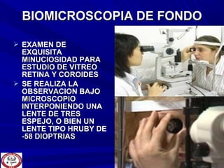  EXAMEN DEEXAMEN DE
EXQUISITAEXQUISITA
MINUCIOSIDAD PARAMINUCIOSIDAD PARA
ESTUDIO DE VITREOESTUDIO DE VITREO
RETINA Y COROIDESRETINA Y COROIDES
 SE REALIZA LASE REALIZA LA
OBSERVACION BAJOOBSERVACION BAJO
MICROSCOPIOMICROSCOPIO
INTERPONIENDO UNAINTERPONIENDO UNA
LENTE DE TRESLENTE DE TRES
ESPEJO, O BIEN UNESPEJO, O BIEN UN
LENTE TIPO HRUBY DELENTE TIPO HRUBY DE
-58 DIOPTRIAS-58 DIOPTRIAS
BIOMICROSCOPIA DE FONDOBIOMICROSCOPIA DE FONDO
 