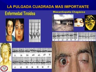LA PULGADA CUADRADA MAS IMPORTANTELA PULGADA CUADRADA MAS IMPORTANTE
 