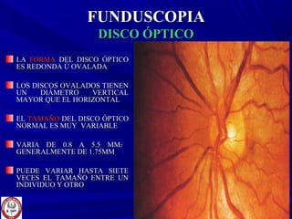 FUNDUSCOPIAFUNDUSCOPIA
DISCO ÓPTICODISCO ÓPTICO
LALA FORMAFORMA DEL DISCO ÓPTICODEL DISCO ÓPTICO
ES REDONDA Ú OVALADAES REDONDA Ú OVALADA
LOS DISCOS OVALADOS TIENENLOS DISCOS OVALADOS TIENEN
UN DIÁMETRO VERTICALUN DIÁMETRO VERTICAL
MAYOR QUE EL HORIZONTALMAYOR QUE EL HORIZONTAL
ELEL TAMAÑOTAMAÑO DEL DISCO ÓPTICODEL DISCO ÓPTICO
NORMAL ES MUY VARIABLENORMAL ES MUY VARIABLE
VARIA DE 0.8 A 5.5 MMVARIA DE 0.8 A 5.5 MM22
GENERALMENTE DE 1.75MMGENERALMENTE DE 1.75MM
PUEDE VARIAR HASTA SIETEPUEDE VARIAR HASTA SIETE
VECES EL TAMAÑO ENTRE UNVECES EL TAMAÑO ENTRE UN
INDIVIDUO Y OTROINDIVIDUO Y OTRO
 