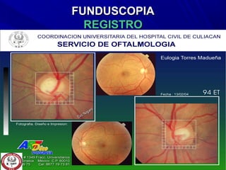 FUNDUSCOPIAFUNDUSCOPIA
REGISTROREGISTRO
 