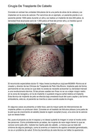 Cirugía De Trasplante De Cabello
Consiste en extraer las unidades foliculares de la una parte de atras de la cabeza y se
implantan en la zona de calvicie. Por servirnos de un ejemplo, un paciente pierde si un
paciente pierde 1000 pelos durante un año y se realiza un implante de dos.000 pelos, la
densidad final alcanzada será de 1.000 pelos al final del primer año y a medida que el
tiempo transcurra la densidad resultante va a ser menor.
El reconocido especialista doctor D. https://www.turnkeylinux.org/user/683669 -Rovira es el
creador y director de las Clínicas de Trasplante de Pelo Vila-Rovira. Implante pelo de forma
permanente en las zonas en que éste no exista se necesite acrecentar su densidad merced
a una revolucionaria técnica. Si las pinzas usadas son finas no se va a dejar ningún rastro
en la zona de recogida y en la de implante ni quedará ninguna señal relativa al implante.
Esta técnica de implante de pelo se efectúa bajo anestesia local del cuero capilar y de forma
ambulatoria, esto es, el paciente se marcha a casa cuando acaba la cirugía.
En algunos casos se presenta un dolor leve, pero la mayor parte de intervenciones de
implante pilífero no producen dolor. Consiste en el traslado de folículos pilosos (una parte de
la piel que da crecimiento al cabello) desde la región occipital (nuca), a la zona de la calvicie
que se desea tratar.
No, pues el proyecto es de mi esposo y no deseo quitarle la imagen ni crear el morbo entre
las personas. Como probablemente ya sabes, las mujeres de raza negra tienen lo que se
conoce como pelo afro. metodo fue injerto pelo de cabello , a menos que se trate del
síntoma de alguna patología, como la anemia un trastorno de agobio ansiedad generalizado,
no es un problema de salud. Entre los beneficios de esta técnica se hallan la apariencia
 