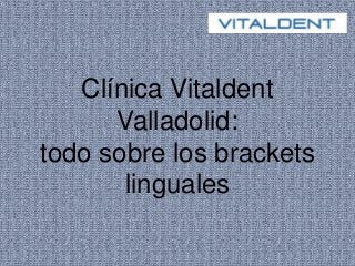 Clínica Vitaldent
Valladolid:
todo sobre los brackets
linguales
 