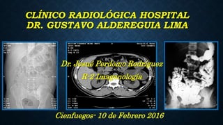 CLÍNICO RADIOLÓGICA HOSPITAL
DR. GUSTAVO ALDEREGUIA LIMA
Cienfuegos- 10 de Febrero 2016
Dr. Josué Perdomo Rodríguez
R-2 Imagenología
 