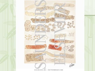 Cặn lắng nước tiểu