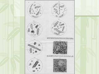 Cặn lắng nước tiểu