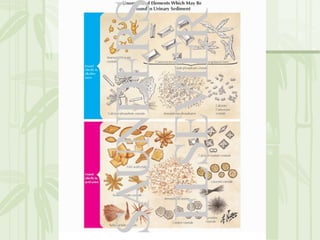 Cặn lắng nước tiểu