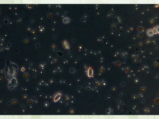 Cặn lắng nước tiểu