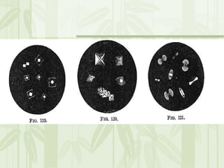Cặn lắng nước tiểu