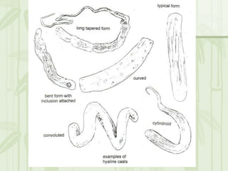 Cặn lắng nước tiểu