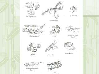 Cặn lắng nước tiểu