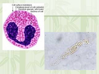 Cặn lắng nước tiểu