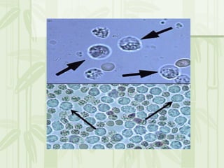 Cặn lắng nước tiểu