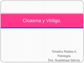 Cloasma y Vitíligo.




              Tonatihu Robles A.
                  Patología.
            Dra. Guadalupe García.
 
