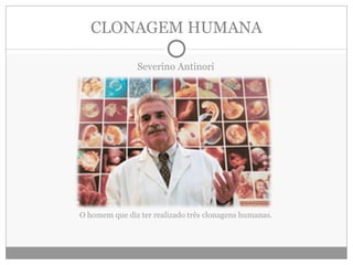 CLONAGEM HUMANA Severino Antinori O homem que diz ter realizado três clonagens humanas. 