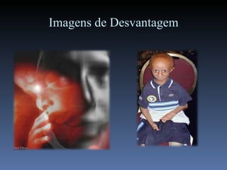 Imagens de Desvantagem 