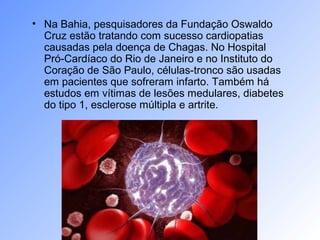 • Na Bahia, pesquisadores da Fundação Oswaldo
Cruz estão tratando com sucesso cardiopatias
causadas pela doença de Chagas. No Hospital
Pró-Cardíaco do Rio de Janeiro e no Instituto do
Coração de São Paulo, células-tronco são usadas
em pacientes que sofreram infarto. Também há
estudos em vítimas de lesões medulares, diabetes
do tipo 1, esclerose múltipla e artrite.
 