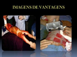 IMAGENS DE VANTAGENS

 