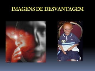 IMAGENS DE DESVANTAGEM

 