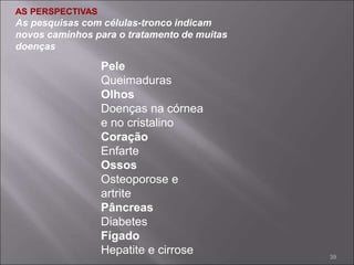 AS PERSPECTIVAS
As pesquisas com células-tronco indicam
novos caminhos para o tratamento de muitas
doenças
Pele
Queimaduras
Olhos
Doenças na córnea
e no cristalino
Coração
Enfarte
Ossos
Osteoporose e
artrite
Pâncreas
Diabetes
Fígado
Hepatite e cirrose 39
 