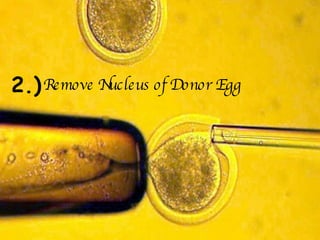 2.) Remove Nucleus of Donor Egg