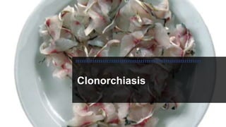Clonorchiasis
 