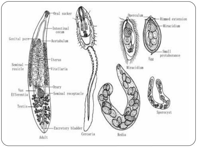 Clonorchiasis wikidoc