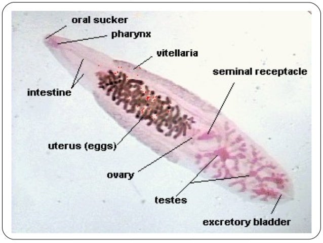 Clonorchiasis sinensis