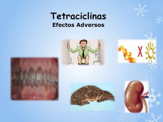 Tetraciclinas 
Efectos Adversos 
 